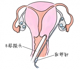 幼儿学画画，保定捐卵宝宝学画画，学画画的好处，如何学画画