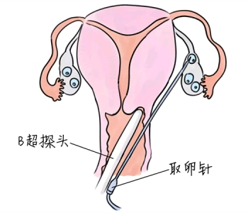 幼儿学画画，保定捐卵宝宝学画画，学画画的好处，如何学画画